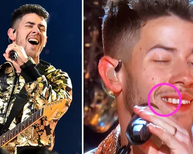 Nick Jonas performs at the Grammys with food in his teeth