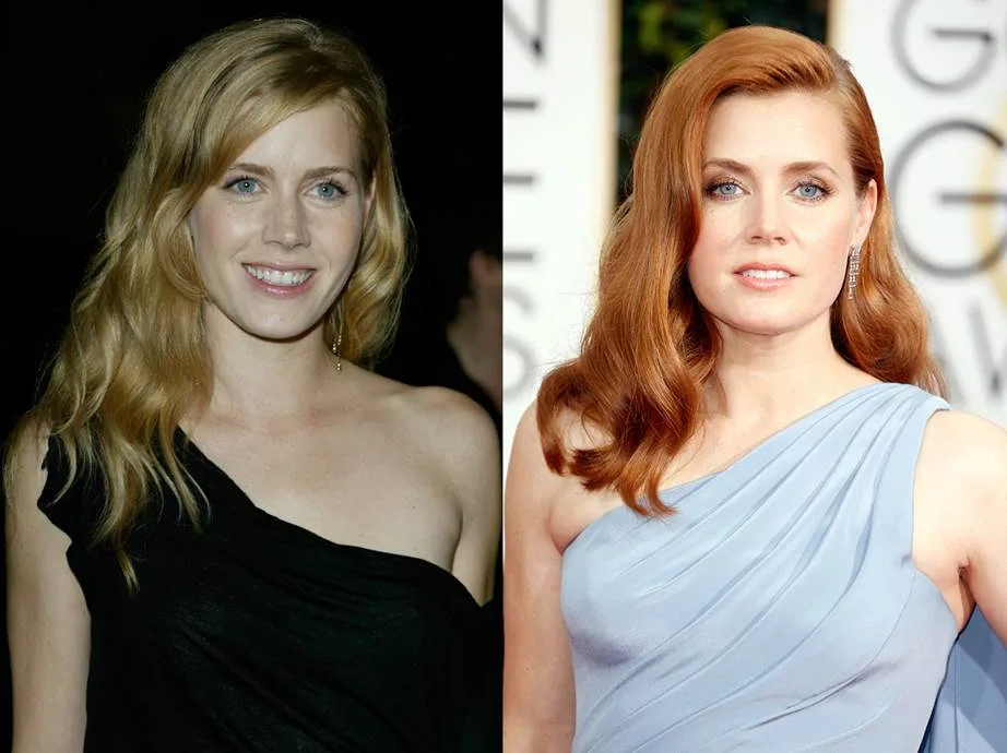 Amy Adams