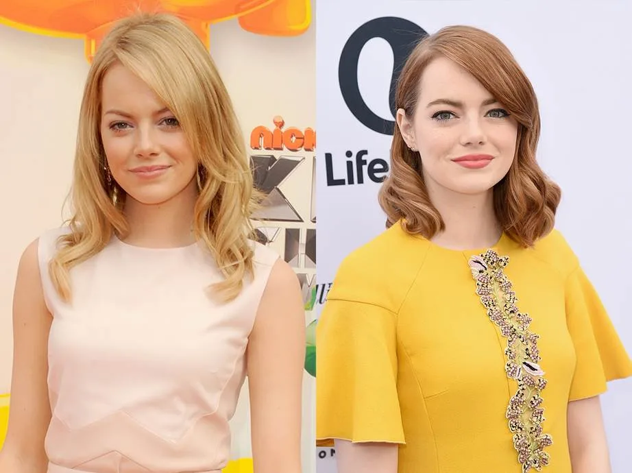 Emma Stone