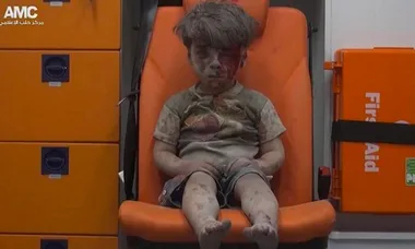 The Brother Of The Boy In The Syrian Photo Dies