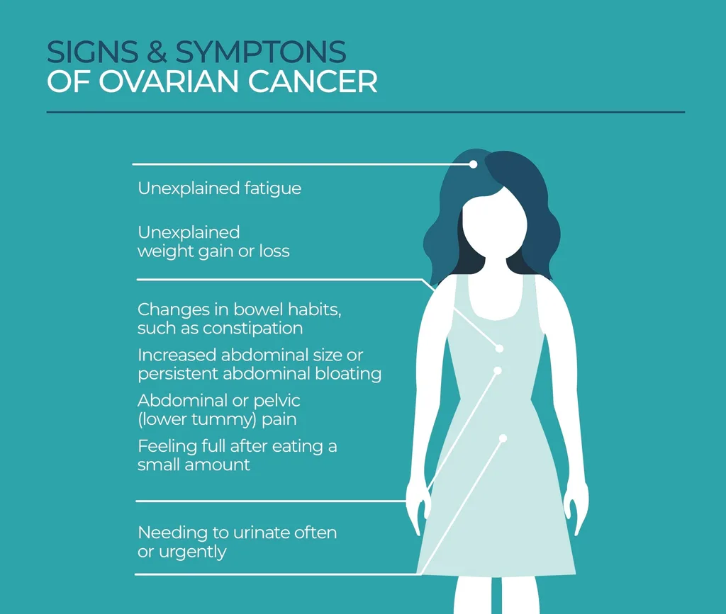 Ovarian Cancer