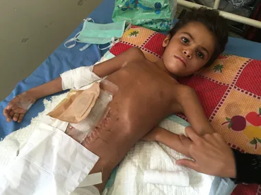 Young boy lies on a hospital bed with bandages on his abdomen and arm.