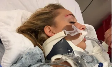 Woman with neck brace and breathing tube in hospital bed, forehead injury visible.