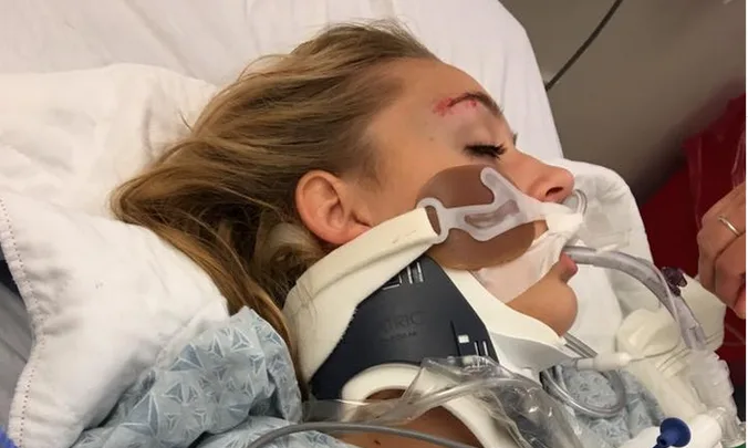 Woman with neck brace and breathing tube in hospital bed, forehead injury visible.