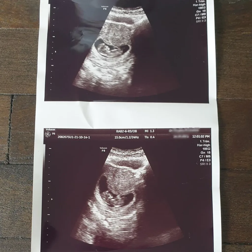 Dami Im pregnant