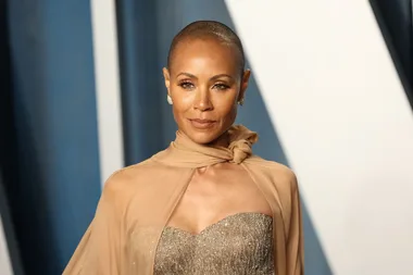 What Is Alopecia? The Autoimmune Disease Jada Pinkett Smith Has Brought Awareness To