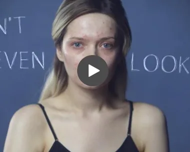 How this woman is powerfully shaming her acne haters