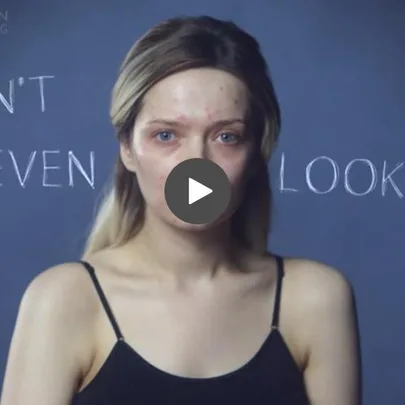 Woman with acne in a black tank top looks at the camera; background text reads "DON'T EVEN LOOK". Video play button over the image.