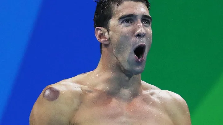 Michael Phelps.