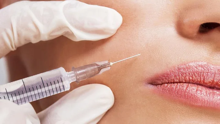 Dermal fillers