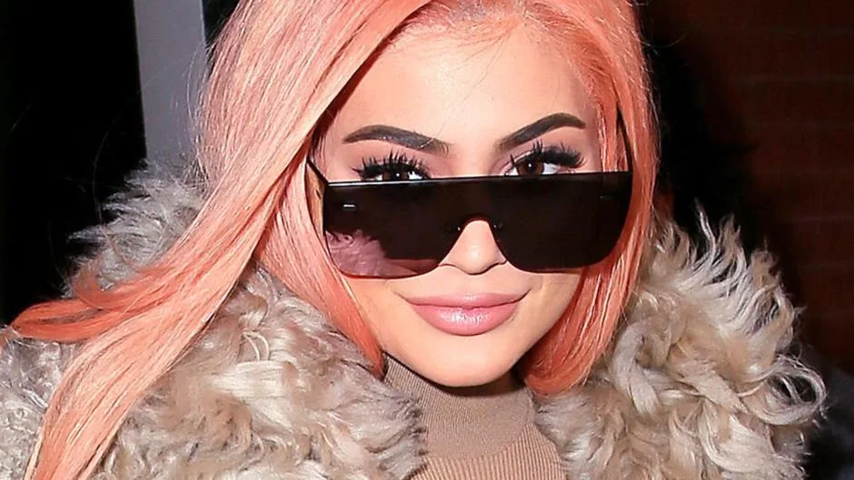 Kylie Jenner lip injections