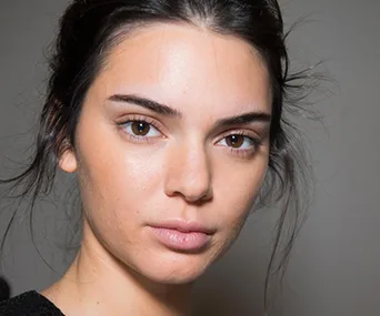 kendall jenner skin acne