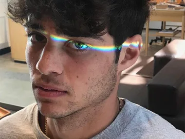 Noah Centineo Scar