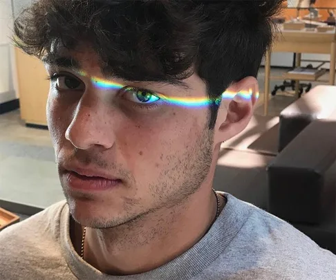 Noah Centineo Scar