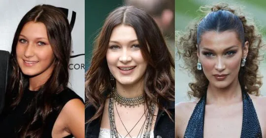 Bella Hadid’s Before & After Beauty Evolution