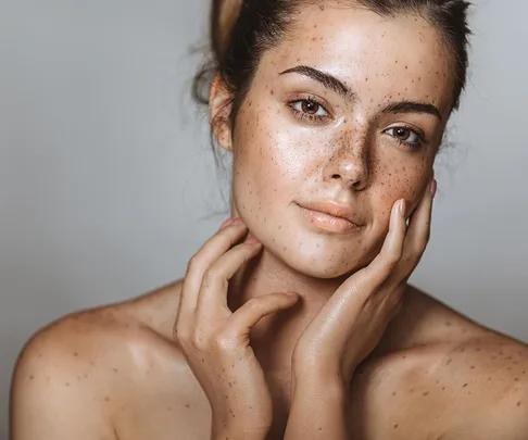 A woman with freckles gently touching her face, showcasing natural beauty and clear skin.