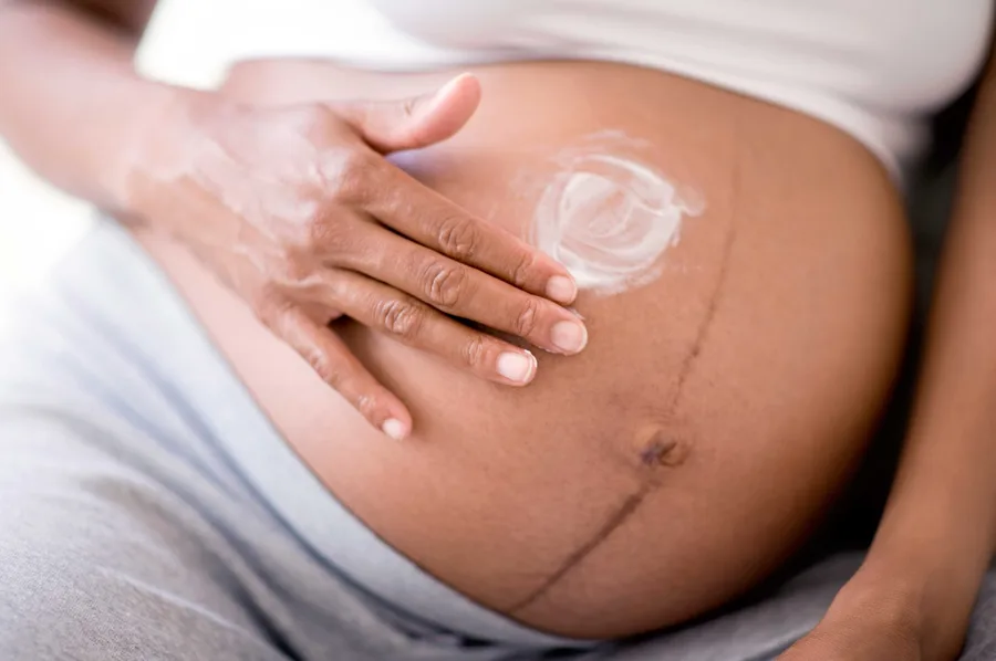 Pregnant belly with hand applying lotion, showing linea nigra, a common pregnancy skin change.
