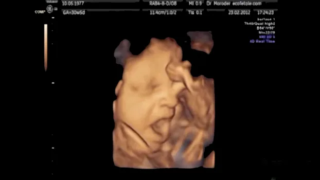 4D Ultrasound