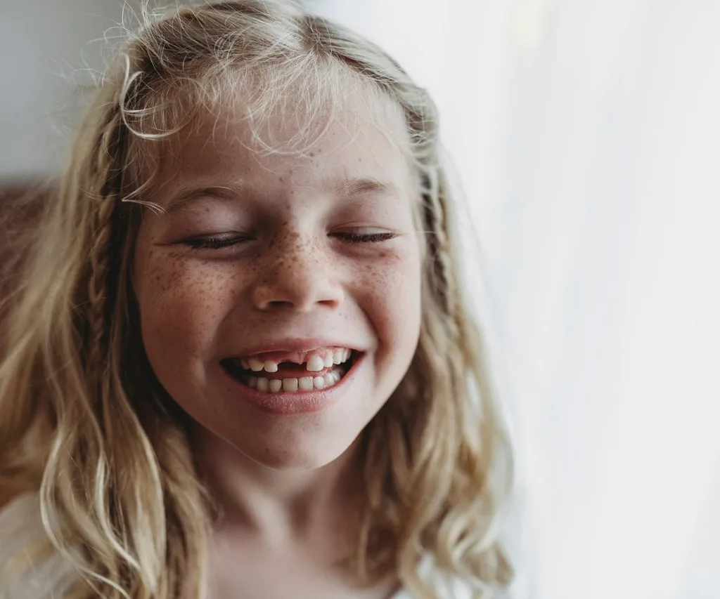 girl with missing teeth smiling at camera