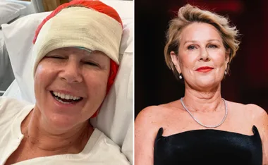 Julia Morris reveals skin cancer diagnosis and urges people to ‘slip, slop, slap’