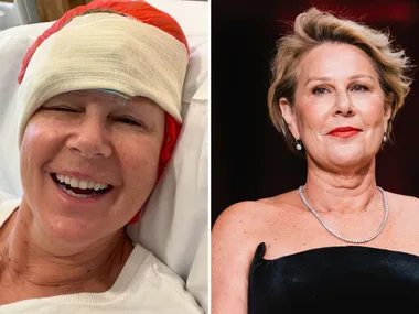 Julia Morris reveals skin cancer diagnosis and urges people to ‘slip, slop, slap’