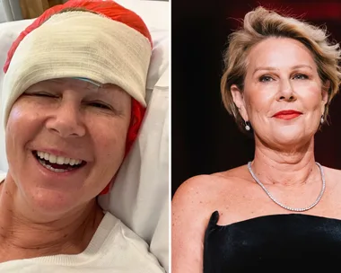 Julia Morris reveals skin cancer diagnosis and urges people to ‘slip, slop, slap’