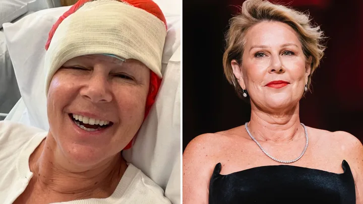 Julia Morris reveals skin cancer diagnosis and urges people to ‘slip, slop, slap’