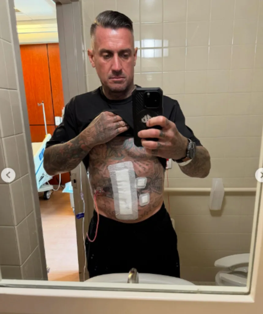 Carey's injuries