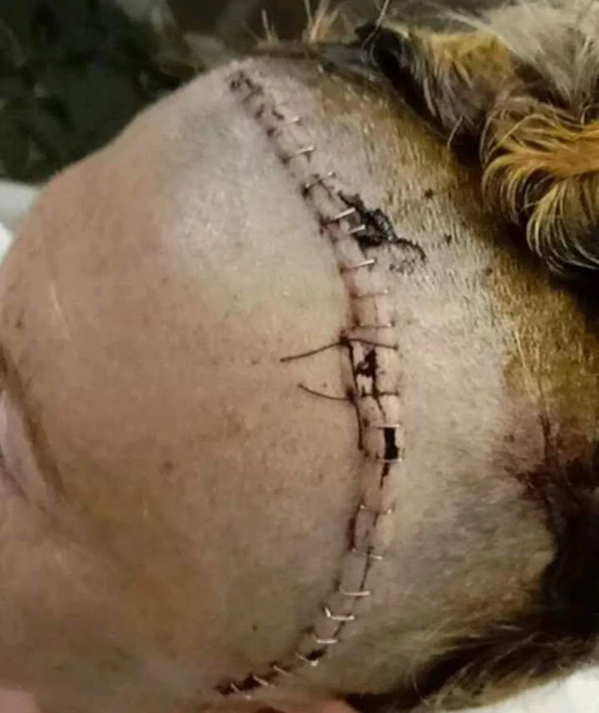 My head showing 32 staples afer surgery. (Image: Supplied)