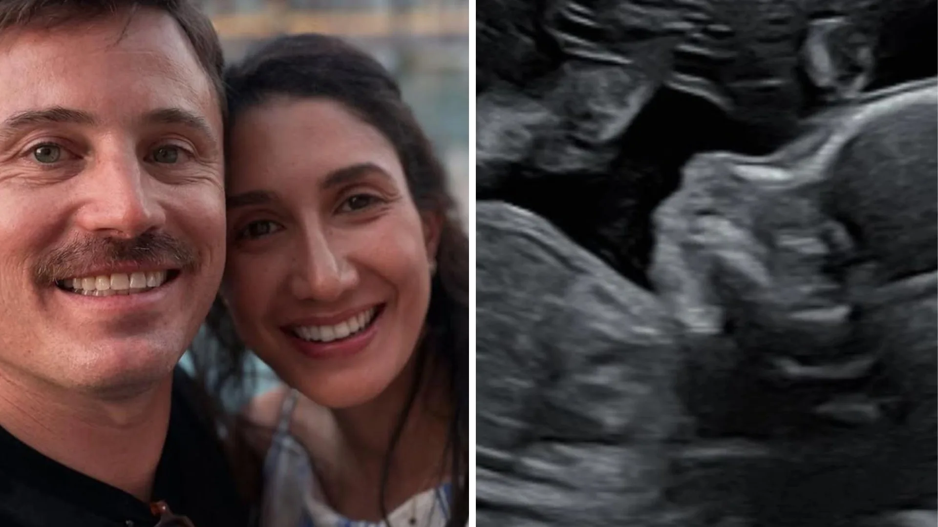 Sunrise weatherman James Tobin and his wife Farrah are expecting their first child together