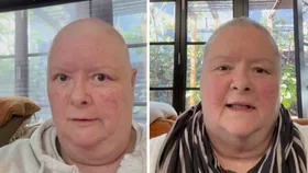 Magda Szubanski shares rare update on her cancer treatment