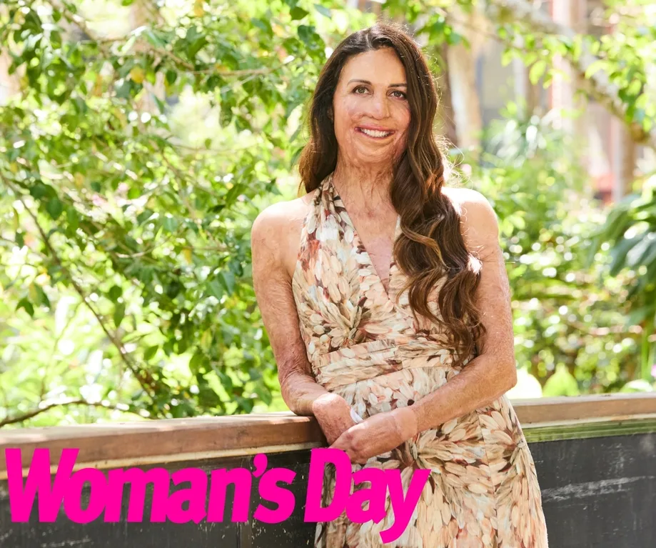 Exclusive Turia Pitt reveals secret pain she's been hiding Now To Love