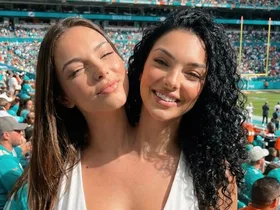 These conjoined twins had social media obsessed. Now their secret is out.