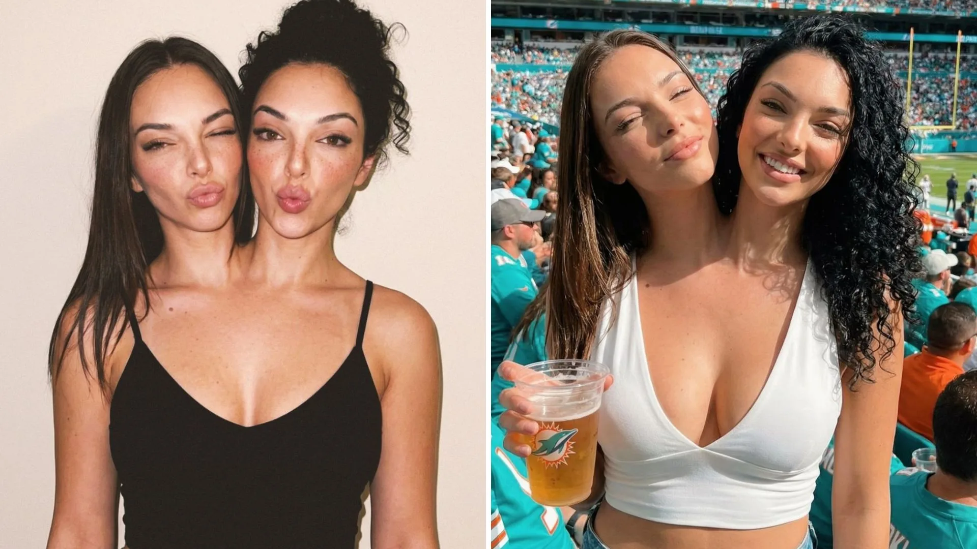 These conjoined twins had fans obsessed. Now their secret is out | Now To Love