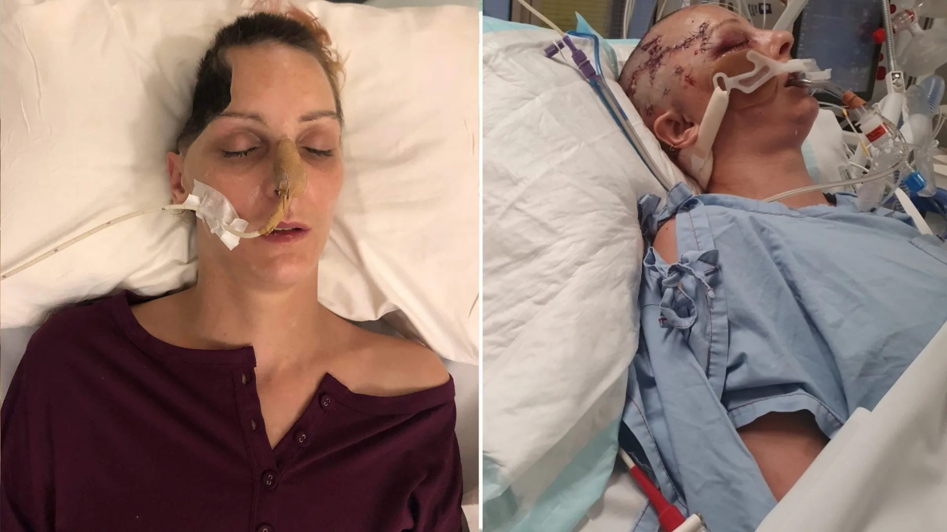 Sara-Jane was attacked with a hammer while sleeping on the couch.