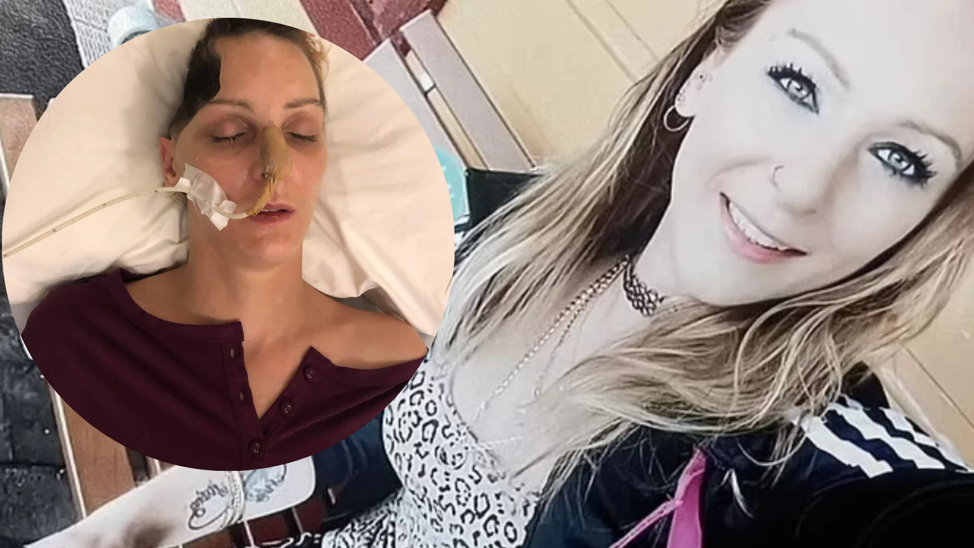 Attacked with a hammer while sleeping