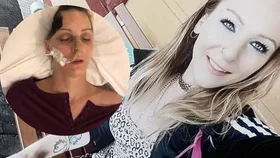 Attacked with a hammer while sleeping