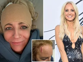 ‘Looked like a crime scene’: Carrie Bickmore injury pics shock