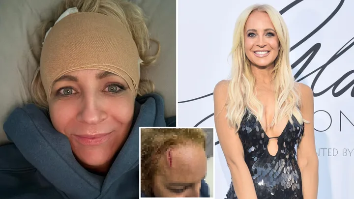 ‘Looked like a crime scene’: Carrie Bickmore injury pics shock