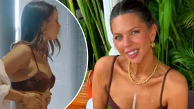 MAFS' bec zacharia rib surgery