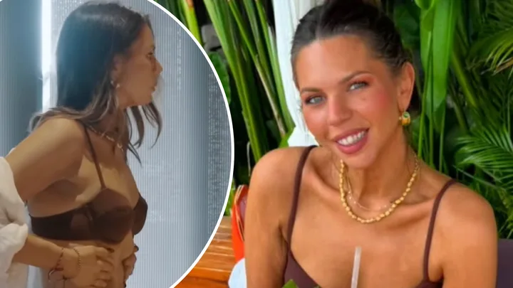 MAFS' bec zacharia rib surgery