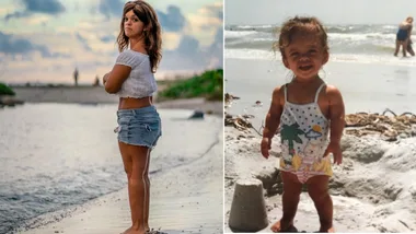 Kristen DeAndrade after the limb-lengthening process and when she was a child. (Images: Supplied)