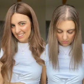 Going bald launched my career!