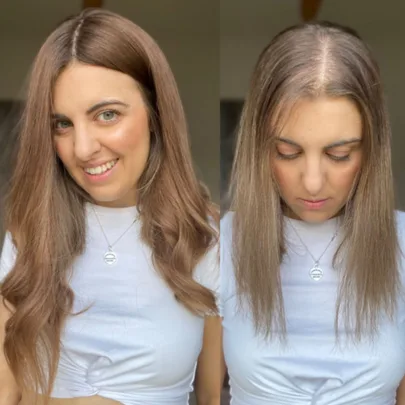 Going bald launched my career!
