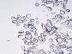 Bubbles rising in clear water against a light background.
