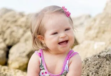 A young child with Down syndrome smiling, sitting on rocks, wearing a floral outfit with a pink hair clip.