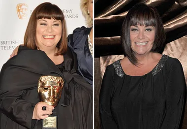 Dawn French before and after weight loss, holding a BAFTA award on the left and smiling in a black dress on the right.