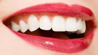 Seven reasons to smile