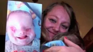 Mother's emotional tribute to baby born without eyes