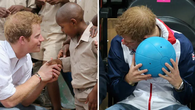 His Royal Baldness: Prince Harry losing his hair